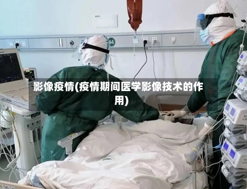 影像疫情(疫情期间医学影像技术的作用)-第3张图片