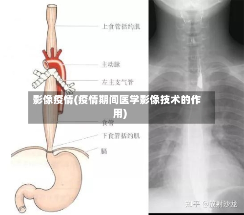 影像疫情(疫情期间医学影像技术的作用)-第2张图片