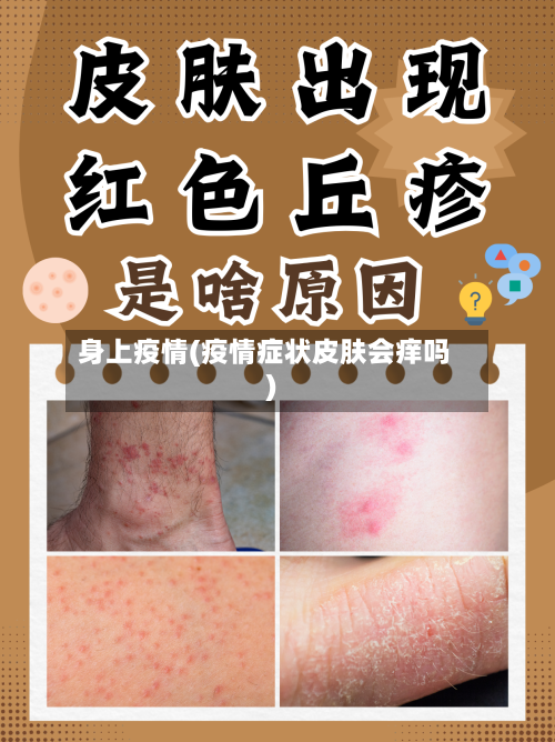 身上疫情(疫情症状皮肤会痒吗)