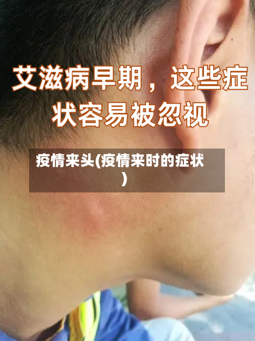 疫情来头(疫情来时的症状)