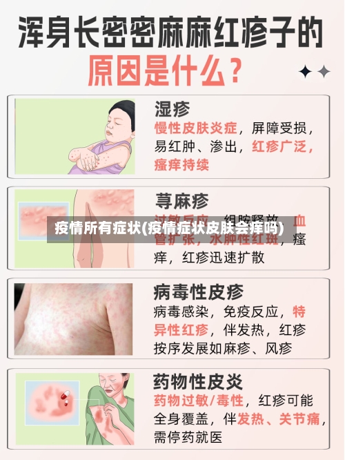 疫情所有症状(疫情症状皮肤会痒吗)-第2张图片