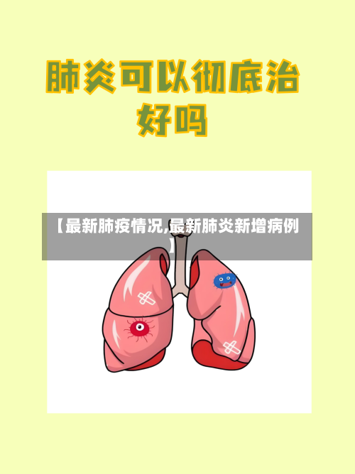 【最新肺疫情况,最新肺炎新增病例】