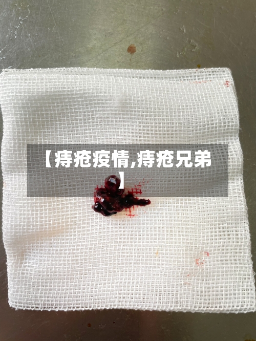 【痔疮疫情,痔疮兄弟】