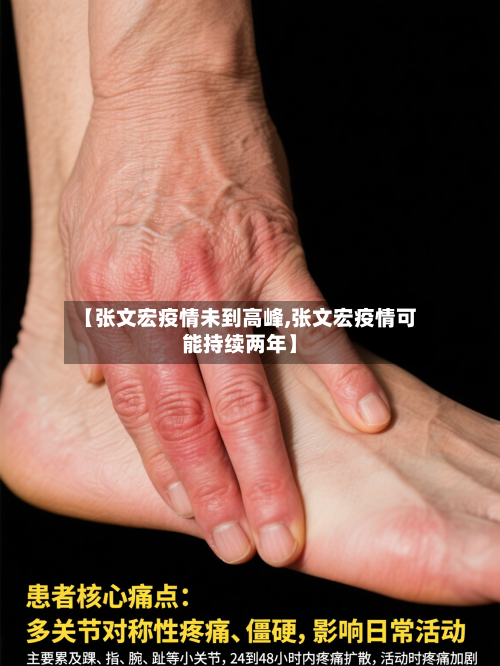 【张文宏疫情未到高峰,张文宏疫情可能持续两年】