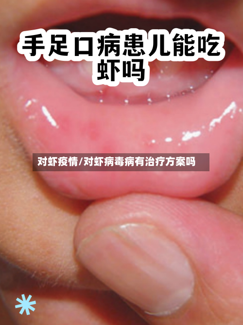 对虾疫情/对虾病毒病有治疗方案吗