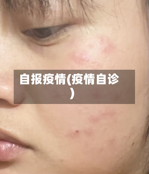 自报疫情(疫情自诊)-第3张图片