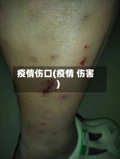 疫情伤口(疫情 伤害)