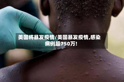 美国将暴发疫情/美国暴发疫情,感染病例超750万!