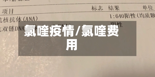 氯喹疫情/氯喹费用-第2张图片